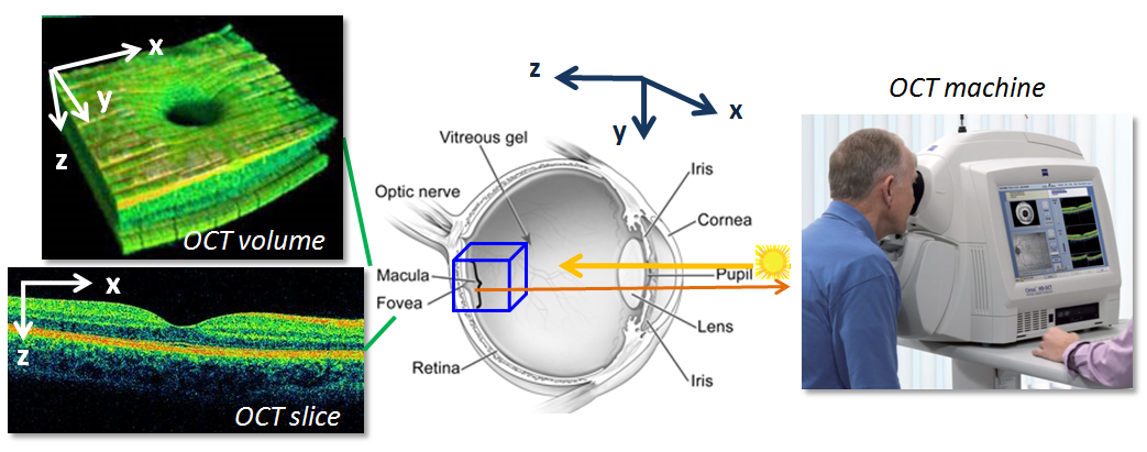 Метод оптической когерентной томографии (окт). ОСТ (Optical coherence tomography). Ретина томография. HRT томограф.